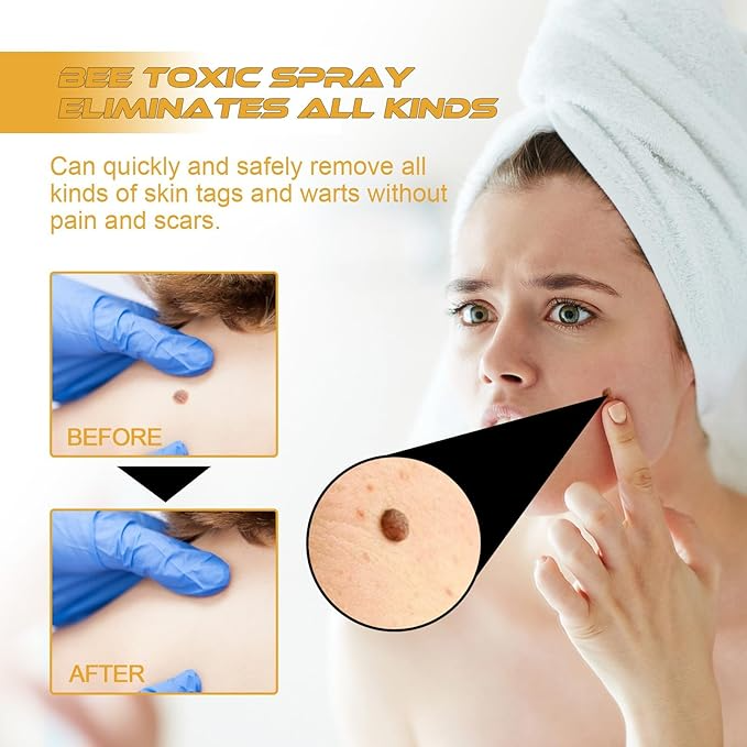 Bee Venom Repair Spray Original