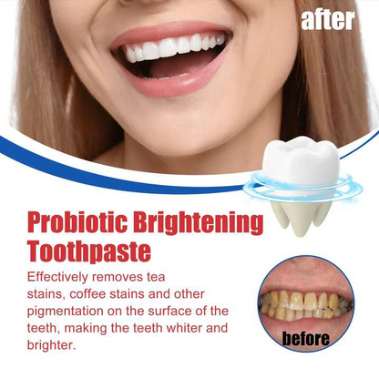 SP-6 Ultra Whitening Toothpaste