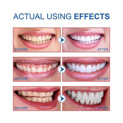 SP-6 Ultra Whitening Toothpaste