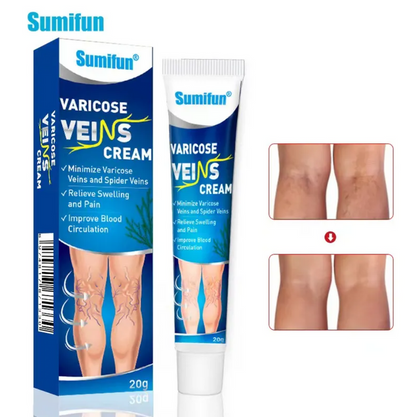 Varicose Veins Ointment